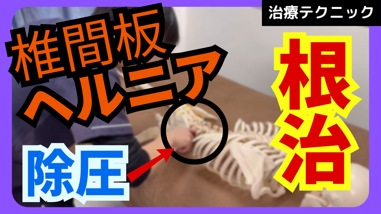 なかなか改善しない腰椎椎間板ヘルニアを根治させる除圧テクニックをご紹介！！